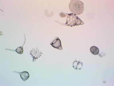 Radiolaria at 100x magnification. These microorganisms have skeletons made of silica, the main ingredient in glass.